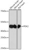 Metabolism Antibodies 3 Anti-PDK2 Antibody CAB4737