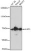 Metabolism Antibodies 3 Anti-ALAS1 Antibody CAB4817