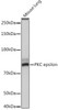 Cell Biology Antibodies 17 Anti-PKC epsilon Antibody CAB4998