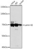 Cell Biology Antibodies 17 Anti-Lamin B2 Antibody CAB5001