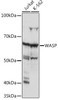 Cell Biology Antibodies 17 Anti-WASP Antibody CAB5132