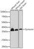 Cell Biology Antibodies 17 Anti-Syntenin Antibody CAB5497