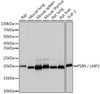 Immunology Antibodies 3 Anti-PSB9 / LMP2 Antibody CAB9549