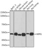 Autophagy Antibodies Anti-WIPI1 Antibody CAB9600