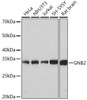 Cell Biology Antibodies 17 Anti-GNB2 Antibody CAB9643