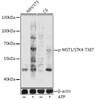 Cell Death Antibodies 2 Anti-Phospho-MST1/STK4-T387 Antibody CABP0906