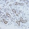 Epigenetics and Nuclear Signaling Antibodies 5 Anti-Phospho-Smad2-T220 Antibody CABP0909