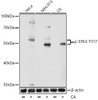 Cell Death Antibodies 2 Anti-Phospho-STK3-T117 Antibody CABP0934