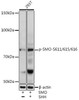 Cell Biology Antibodies 14 Anti-Phospho-SMO-S611/615/616 Antibody CABP0940
