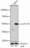 Cell Death Antibodies 2 Anti-Phospho-p53-S6 Antibody CABP0951