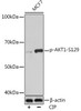 Cell Death Antibodies 2 Anti-Phospho-AKT1-S129 Antibody CABP0981