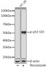 Cell Death Antibodies 2 Anti-Phospho-p53-S33 Antibody CABP0984