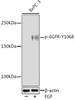 Immunology Antibodies 3 Anti-Phospho-EGFR-Y1068 Antibody CABP0994