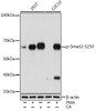 Epigenetics and Nuclear Signaling Antibodies 5 Anti-Phospho-Smad2-S250 Antibody CABP1007
