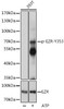 Cell Biology Antibodies 14 Anti-Phospho-EZR-Y353 Antibody CABP1118