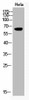 Acetyl-KRT K194 Antibody PACO00070