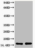 Acetyl-Histone H3 Lys27 Antibody PACO00131