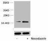 Phospho-Histone H2B Ser32 Antibody PACO00135