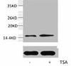 Acetyl-Histone H2B Lys20 Antibody PACO00161
