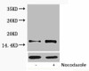 Phospho-Histone H1 Thr17 Antibody PACO00168