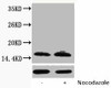Phospho-Histone H2B Ser14 Antibody PACO00172