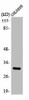 ABHD11 Antibody PACO00355