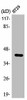 EPHX4 Antibody PACO00359