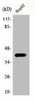 ACTBL2 Antibody PACO00366