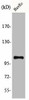 AGBL2 Antibody PACO00542