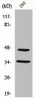 FOXB1/FOXB2 Antibody PACO00816