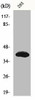 ISL2 Antibody PACO00987