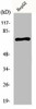 KCNC2 Antibody PACO01007