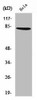 ZNF225 Antibody PACO01725