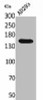 PNPLA6 Antibody PACO02051
