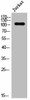 Phospho-EPHA2/EPHA5 Y594 Antibody PACO02631