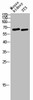 POTEB Antibody PACO02832