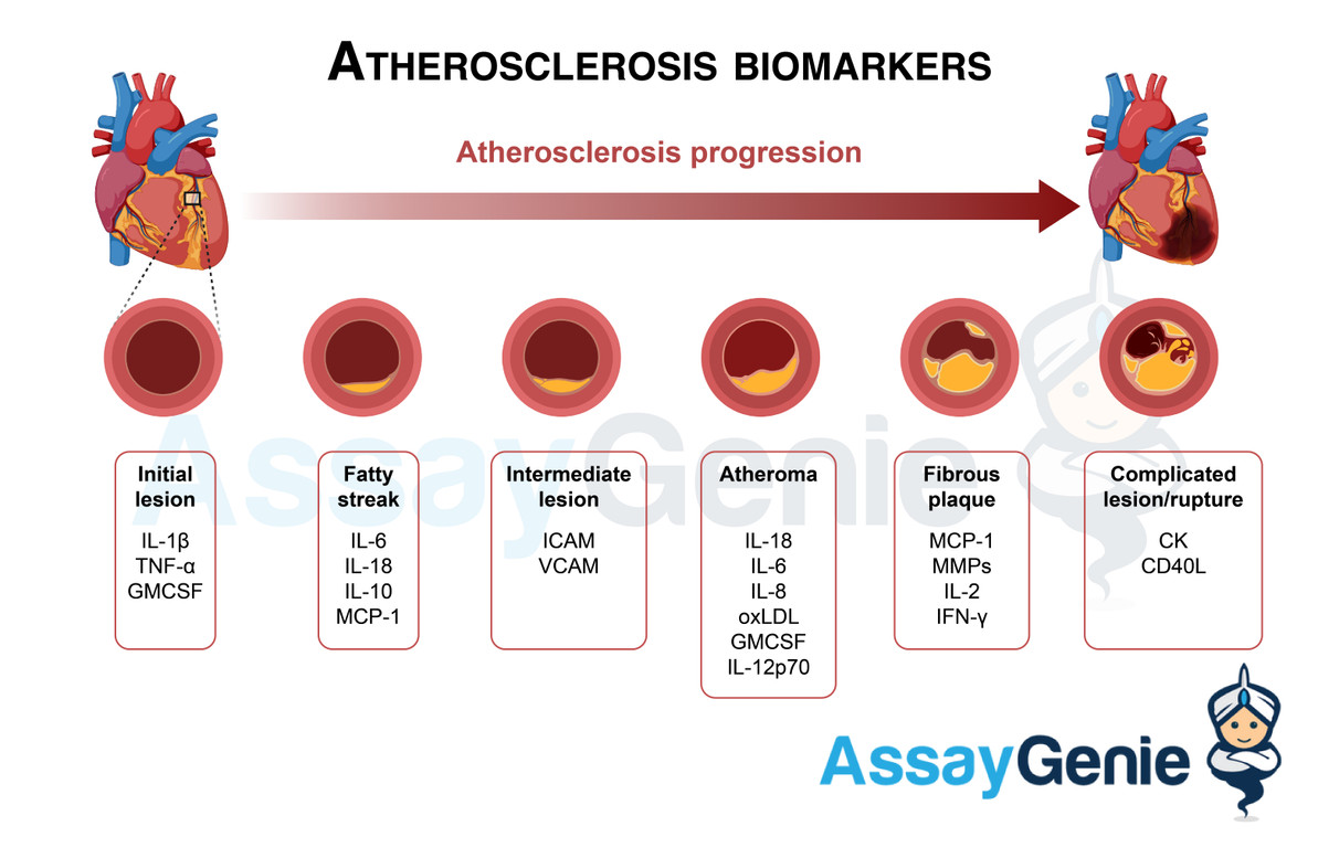 Biomarkers & Inflammatory markers of atherosclerosis