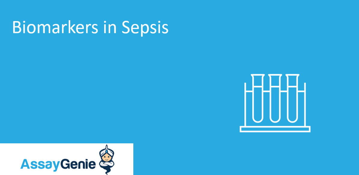 Biomarkers in sepsis: Their Role in Early Detection and Management 