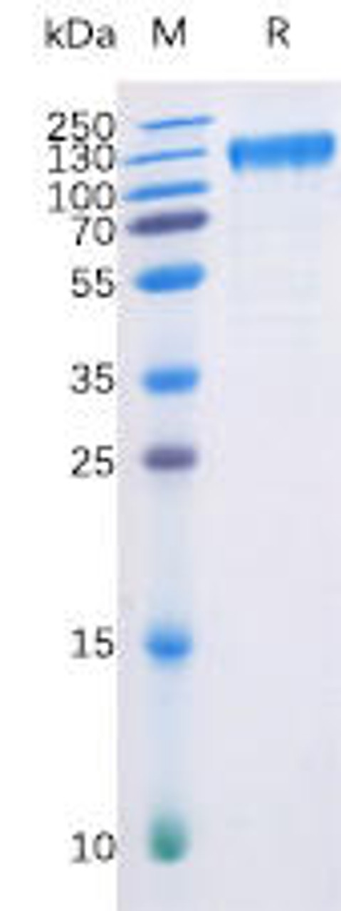 Human FLT3 Recombinant Protein (hFc-His Tag) (HDPT0007)