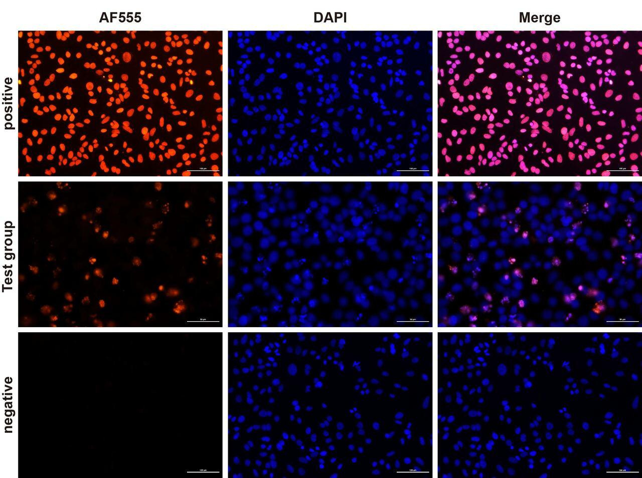 TUNEL 1-Step In Situ Apoptosis Kit (FL555) | Assay Genie