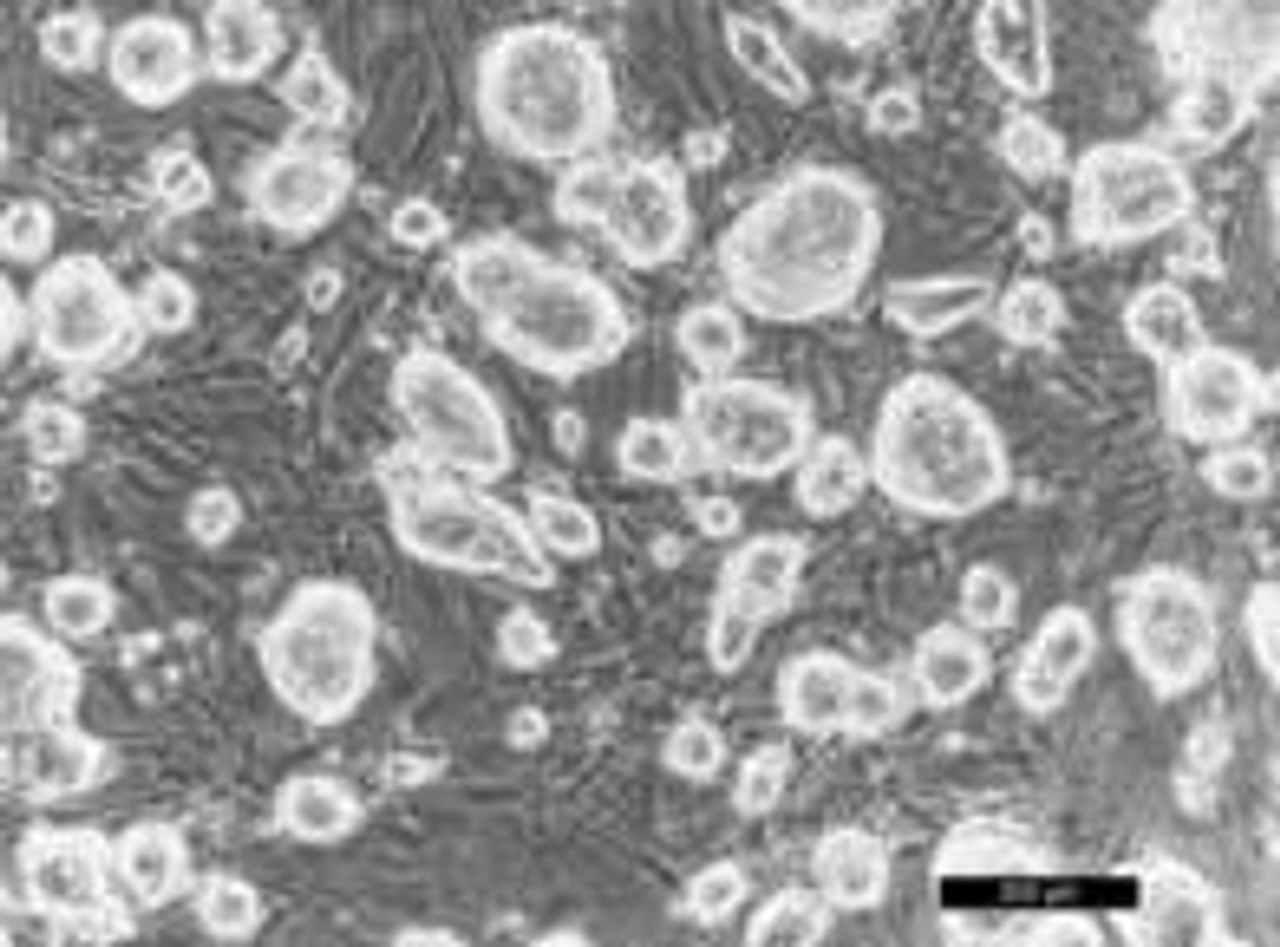 mycoplasma cell culture