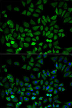 CDK4 Antibody - Human, Mouse, Rat Research | Assay Genie