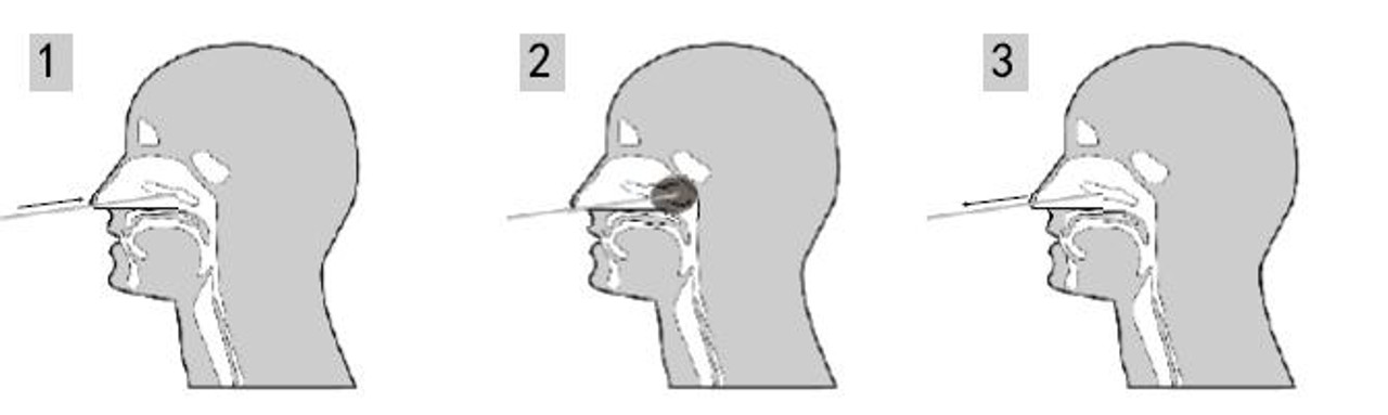 Prélèvement nasal Autotest – COVID-19 RAPID TEST