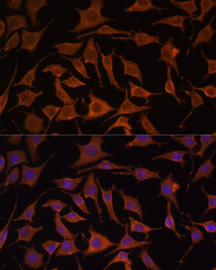 TNF-alpha Antibody - Human,Mouse,Rat | Assay Genie