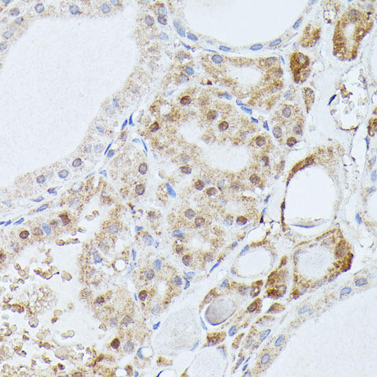PP2A-B56delta/PR61delta/PPP2R5D Antibody | Assay Genie