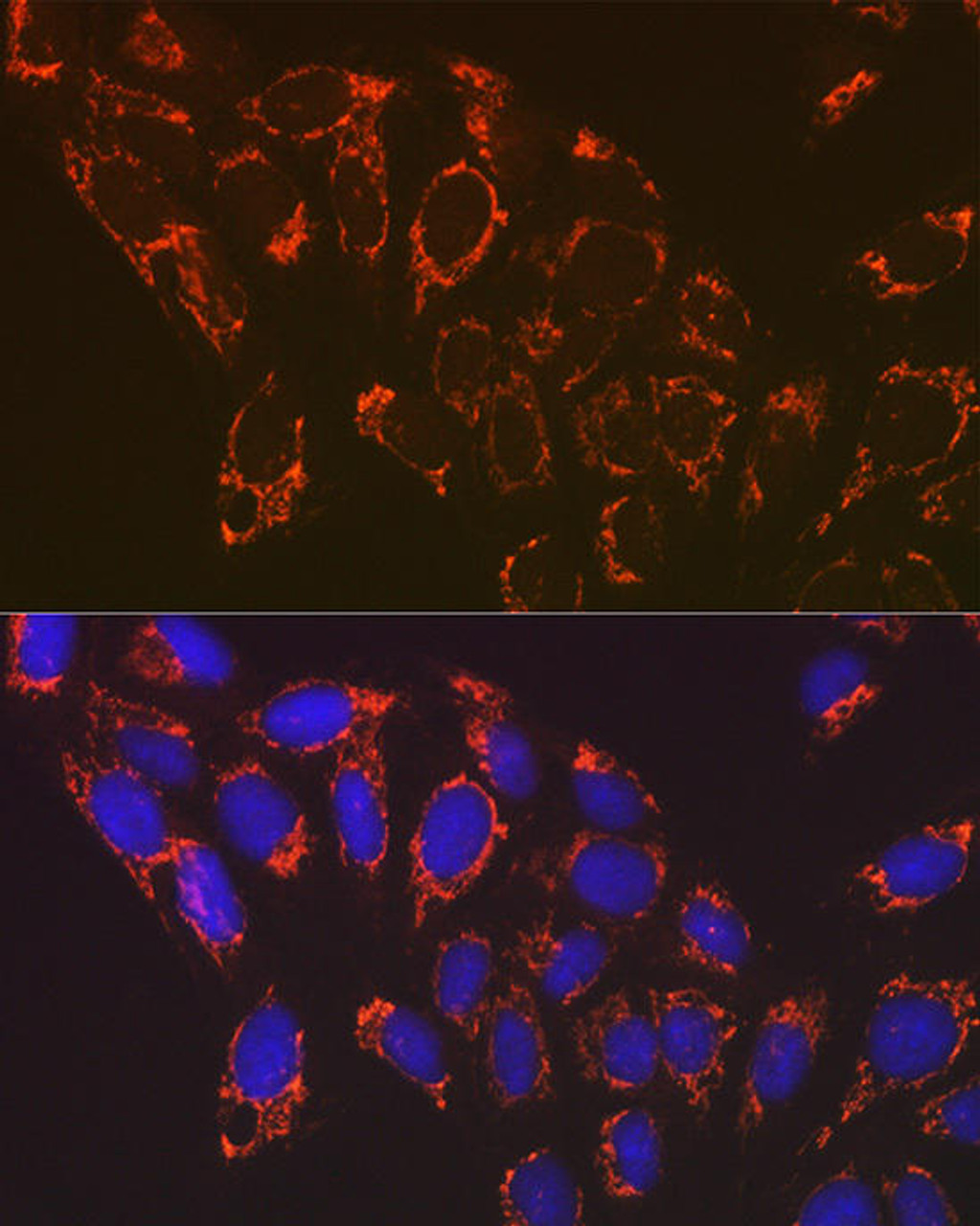 anti-ndufb8-monoclonal-antibody-cab19732