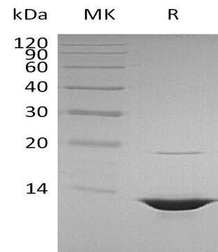 Human HMGB1 Protein (RPES0734)