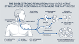 The Bioelectronic Revolution: How Vagus Nerve Stimulation is Redefining Autoimmune Therapy in 2026