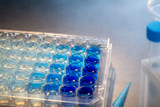 TMB-Substrat im ELISA: Chemie, Protokoll und Fehlerquellen