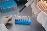 Dilución de anticuerpos: protocolo, cálculos y control de calidad